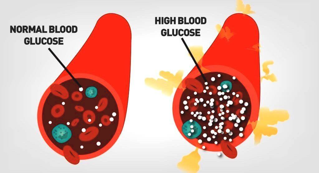normale bloedglucose versus hoge bloedglucose