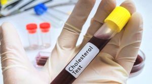 Arts houdt bloedafnamebuisje vast van cholesterol test