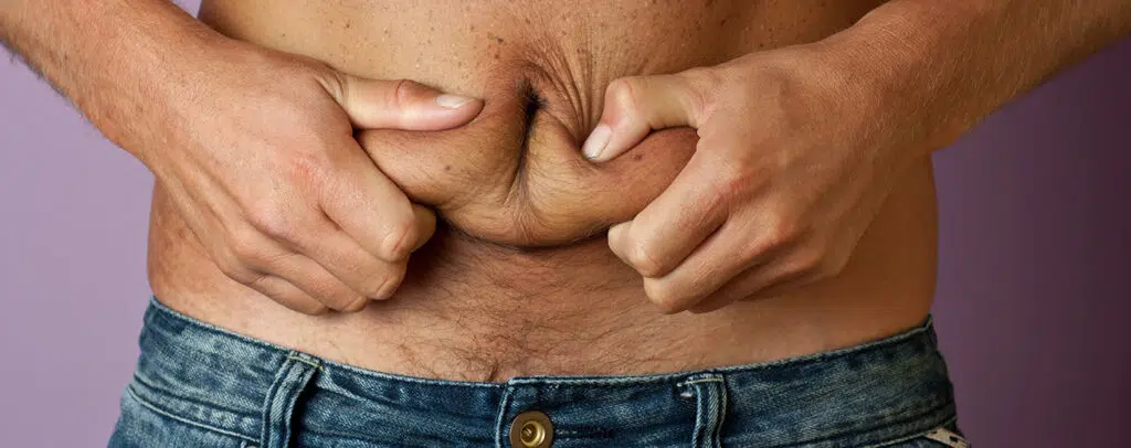 Man houdt zijn buikvet vast met zijn handen op de voorgrond